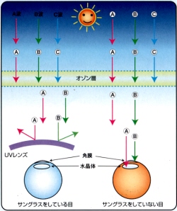 UV